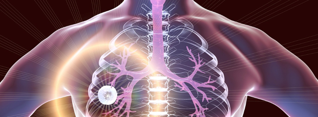 📰 Las secuelas de la tuberculosis: una realidad que el sistema ignora